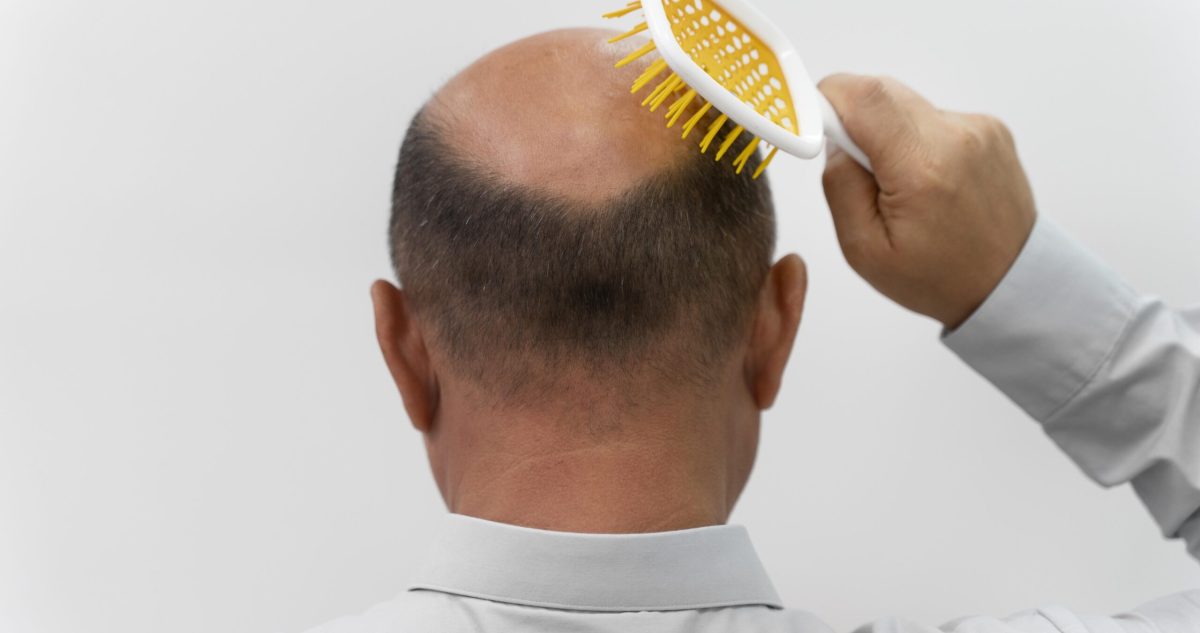 bald man from the back brushing his head with a yellow brush